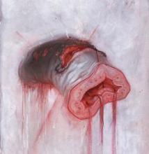 american-heritage-prolapse-solar-flare-2014