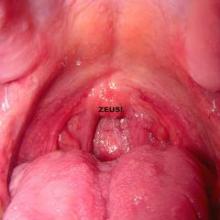 zeus-st-bar-la-muerte-escape-today-set-sanguedischi-shove-smartz-2011